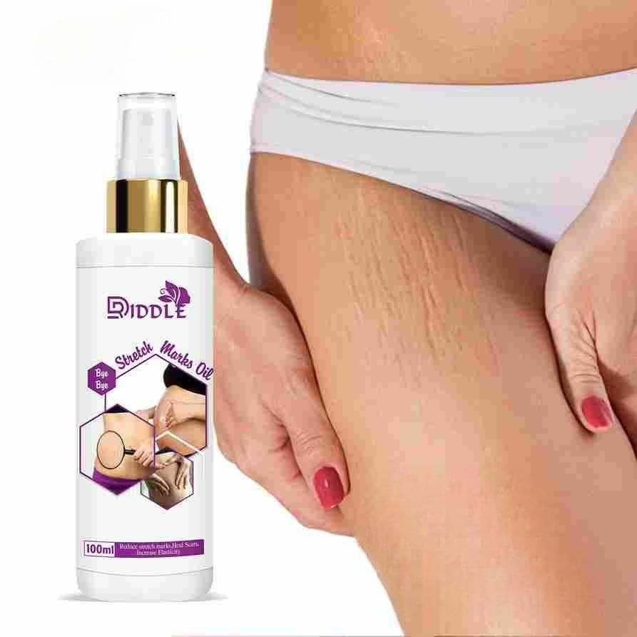 Pregnancy Stretch Mark Removal Oil Scar Removal Pack of 2